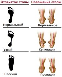 Пронация и супинация стоп